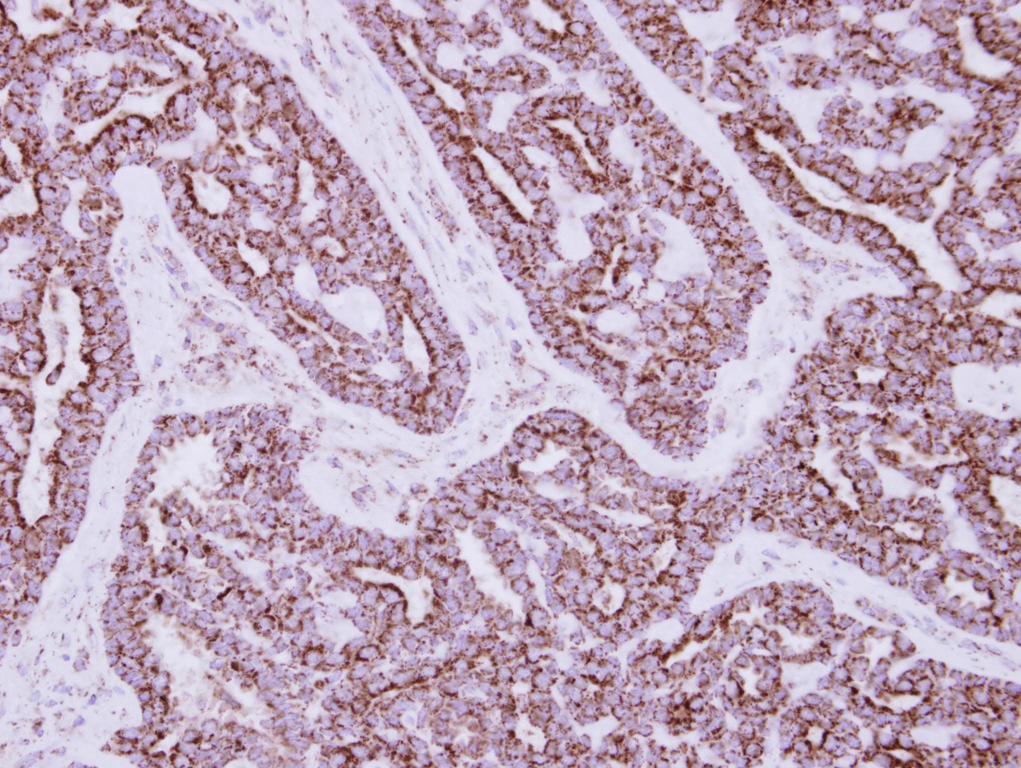 Polyclonal Rabbit anti-Human HIBADH Antibody (IHC, WB)