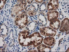 GRHPR / Glyoxylate Reductase Antibody (clone OTI10A3)