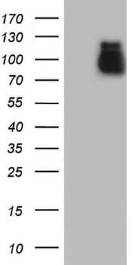 IHC-plus™ ACE2 / ACE-2 Antibody (aa18-237, clone 1G4)