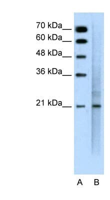 EMA / MUC1 Antibody (aa1192-1241)