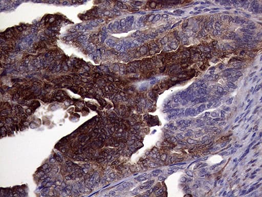 ASS1 / ASS Antibody (C-Terminus, clone OTI3D1)