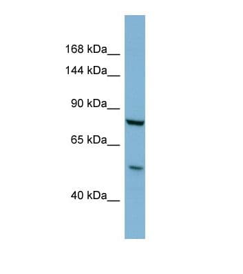 Polyclonal Rabbit anti-Human GALNT5 Antibody (C-Terminus, WB)