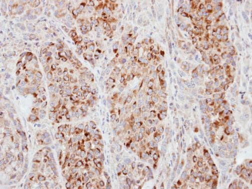 ECT2 Antibody (aa1-44)