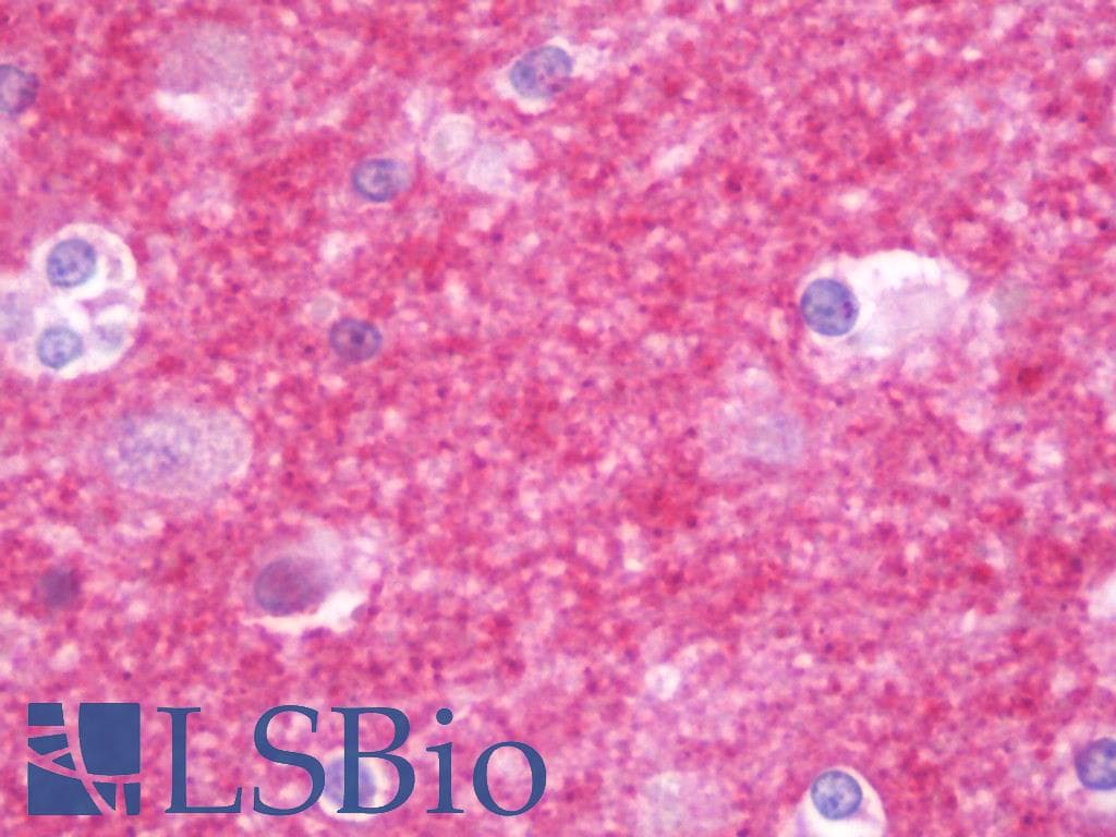 IHC-plus™ PRRT2 Antibody