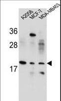 VCX Antibody (aa1-30)