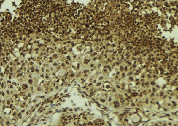 ZNF7 Antibody