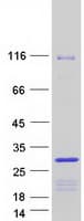 Human CBX5 / HP1 Alpha Protein (Recombinant Myc-DDK (Flag))