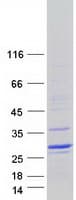 Human DUX5 Protein (Recombinant Myc-DDK (Flag))