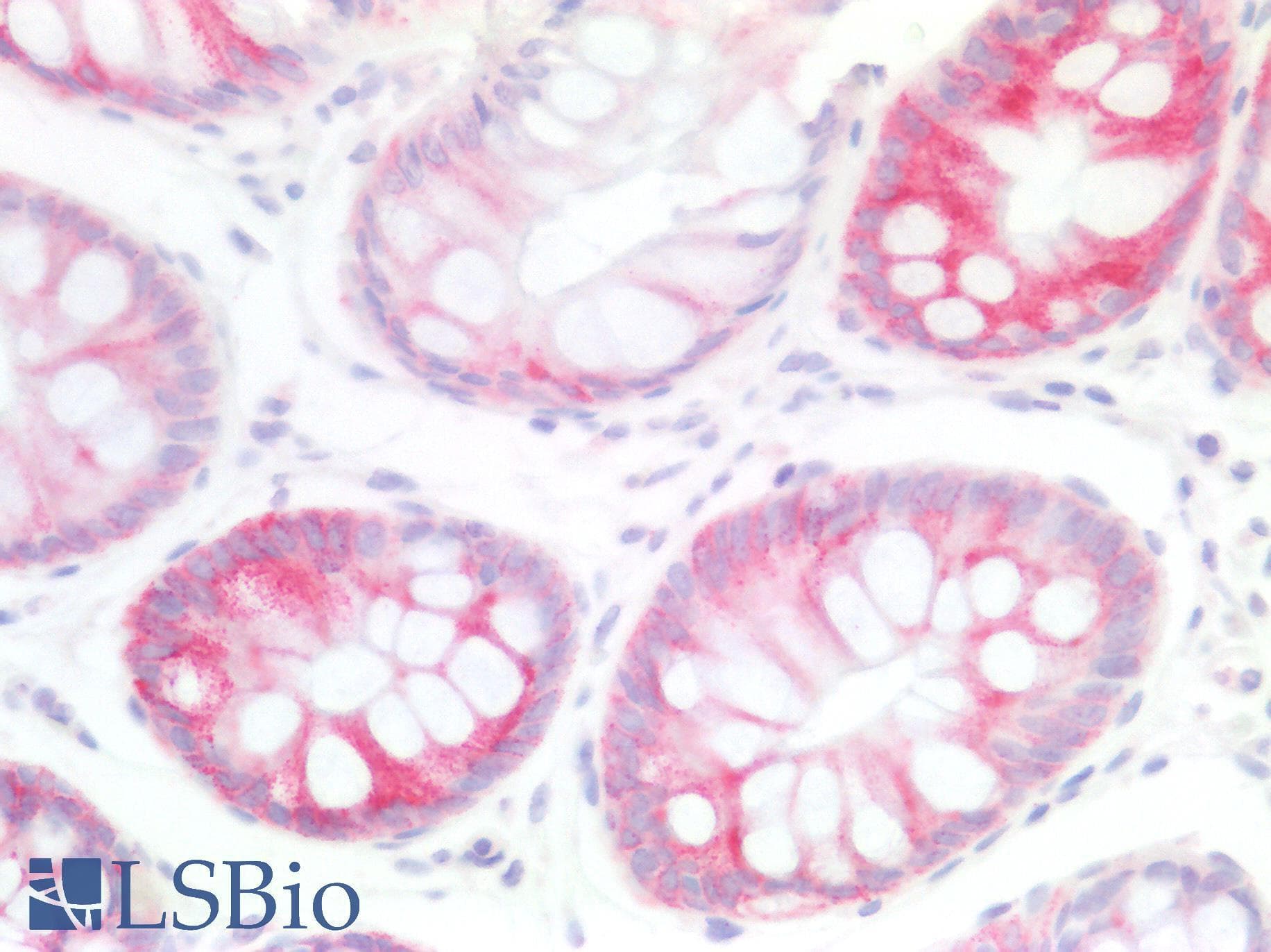 IHC-plus™ Polyclonal Rabbit anti-Human MUC5B Antibody (IHC, IF, WB)