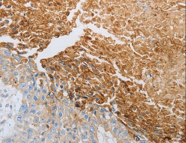 RTN4 / Nogo Antibody