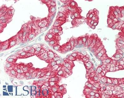 CDCP1 Antibody (clone 2B8, Carrier-free)
