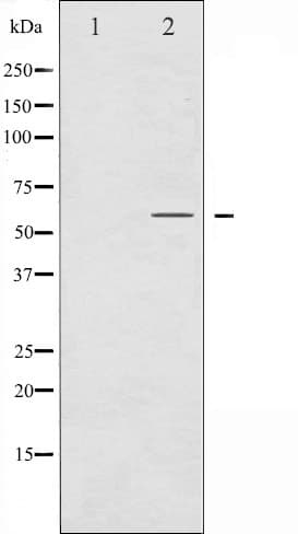 SMAD3 Antibody (phospho-Ser425)