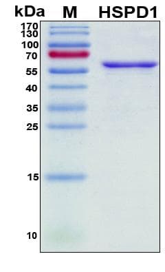 Human HSPD1 / HSP60 Protein (Recombinant His, N-Terminal)