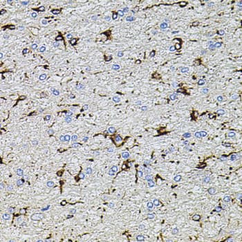 TRPA1 Antibody