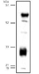 LIPG / Endothelial Lipase Antibody (C-Terminus, DY488)