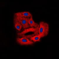 CML / BCR Antibody (phospho-Tyr360)