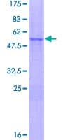Human NKX2-8 Protein (Recombinant GST)