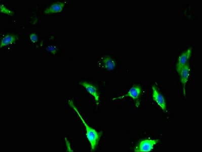 Polyclonal Rabbit anti-Human TSPAN14 Antibody