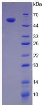 Human IL12A / p35 Protein (Recombinant His, N-Terminal)