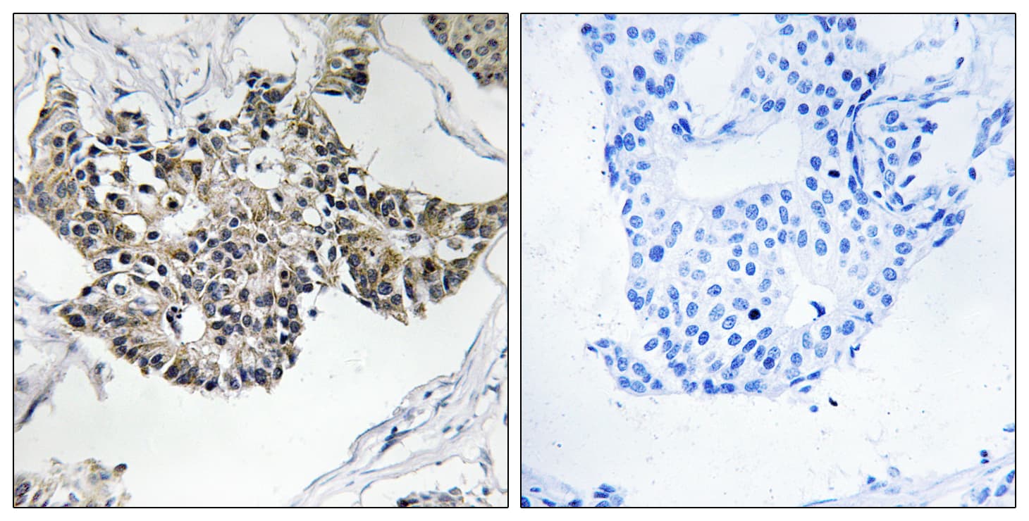 Polyclonal Rabbit anti-Human RSAD1 Antibody (aa298-347, IHC, WB)