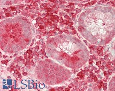 IHC-plus™ NFKB1 / NF-Kappa-B Antibody (aa 1-961)