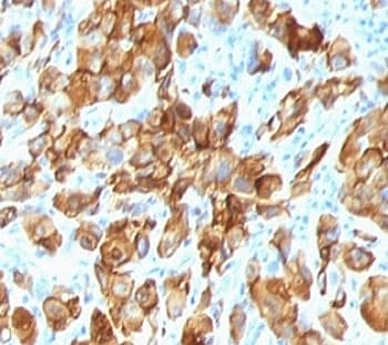 MLANA / Melan-A Antibody (clone SPM540)