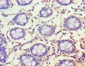FAM160B1 Antibody (aa1-738)