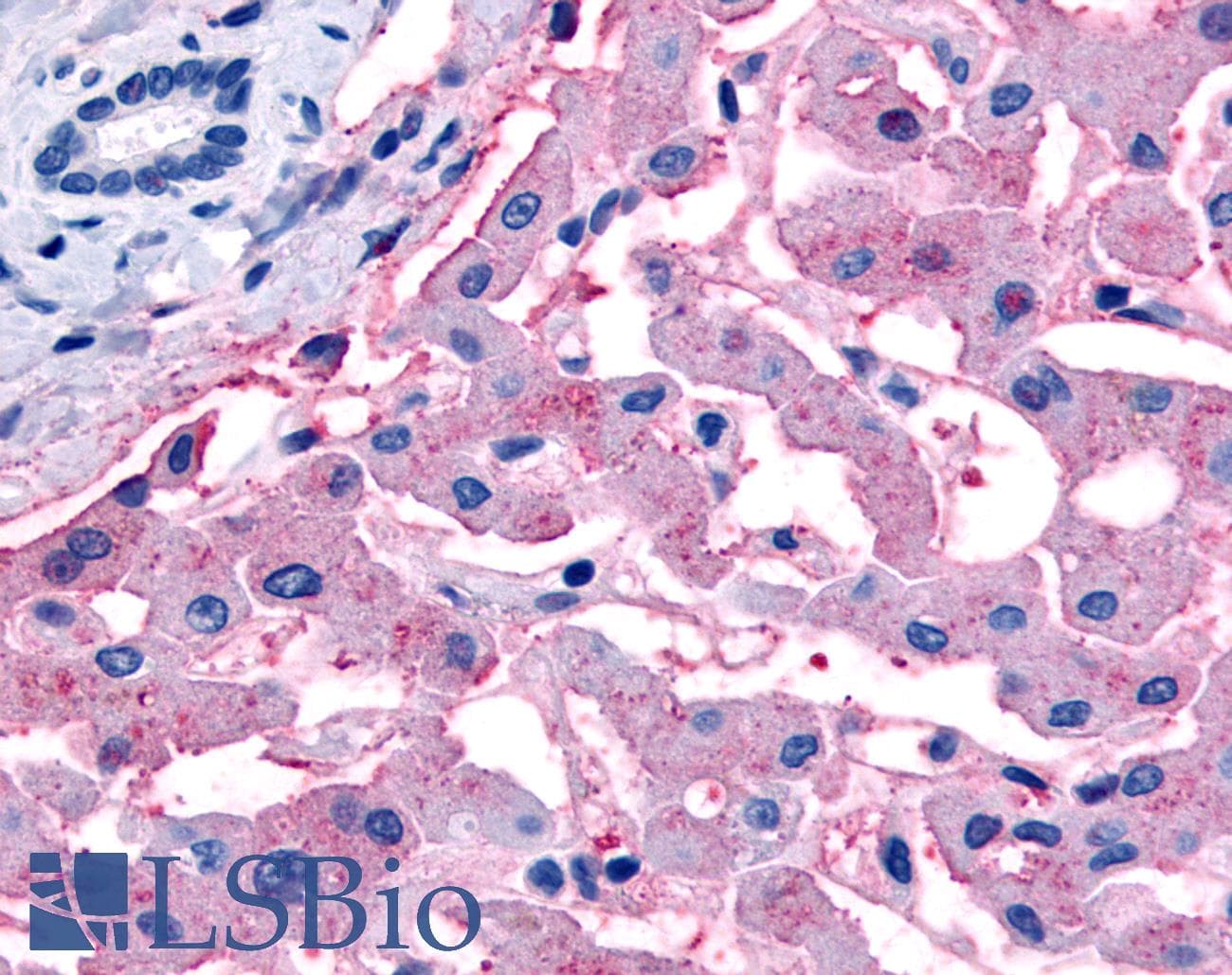 IHC-plus™ Polyclonal Rabbit anti-Human SLC5A4 / SGLT3 Antibody (C-Terminus, IHC)
