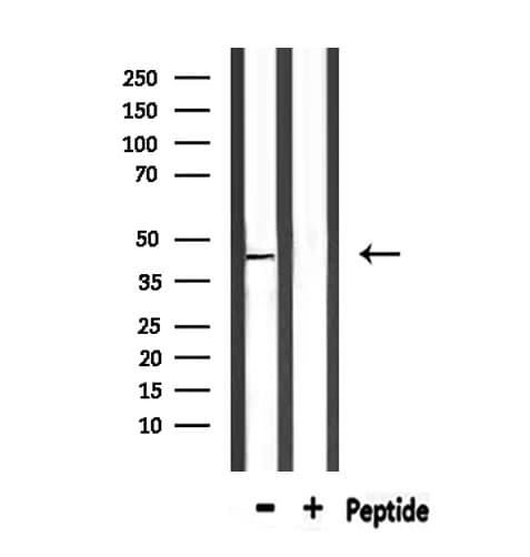 Polyclonal Rabbit anti-Human PTGER1 / EP1 Antibody (IHC, IF, WB)