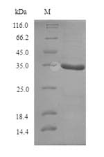 Geobacillus stearothermophilus pcrA Protein (Recombinant 6His, N-terminus)