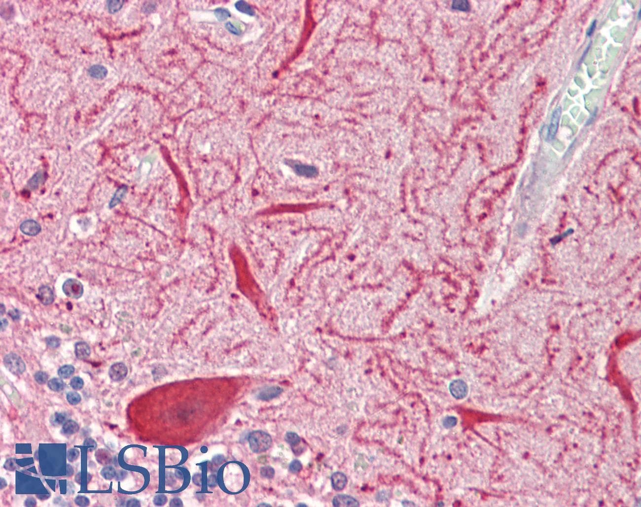 IHC-plus™ SLC2A13 / HMIT / GLUT13 Antibody (aa268-297)