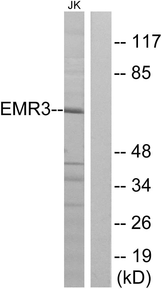 ADGRE3 / EMR3 Antibody (aa603-652)