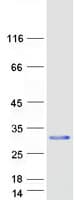 Human KLRD1 / CD94 Protein (Recombinant Myc-DDK (Flag))
