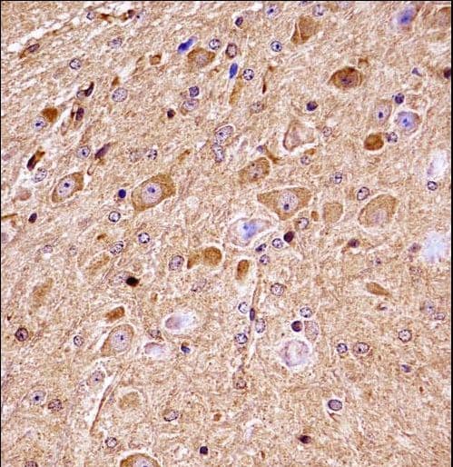 NLK Antibody (aa408-436)