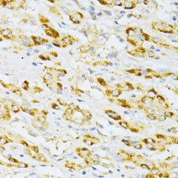 Polyclonal Rabbit anti-Human CD135 / FLT3 Antibody (IHC, WB)
