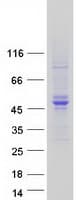 Human GALK2 Protein (Recombinant Myc-DDK (Flag))
