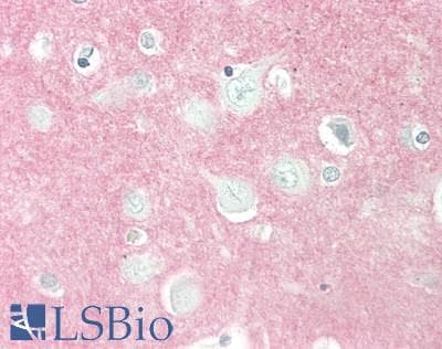 PathPlus™ NCAM / CD56 Antibody (clone 123C3.D5)