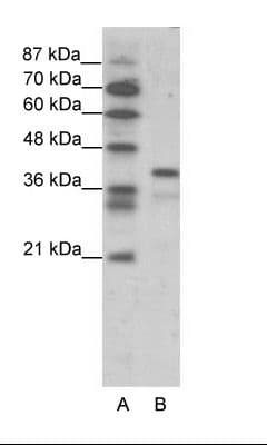 Polyclonal Rabbit anti-Human POU5F1 / OCT4 Antibody (aa114-163, IHC, WB)