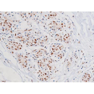 c-Kit / CD117 Antibody (phospho-Tyr703)