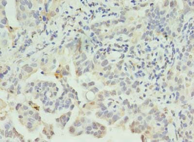 CLEC1A / CLEC-1 Antibody