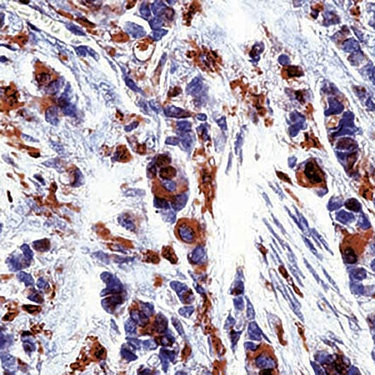 TP / Thymidine Phosphorylase Antibody (clone P-GF.44C)