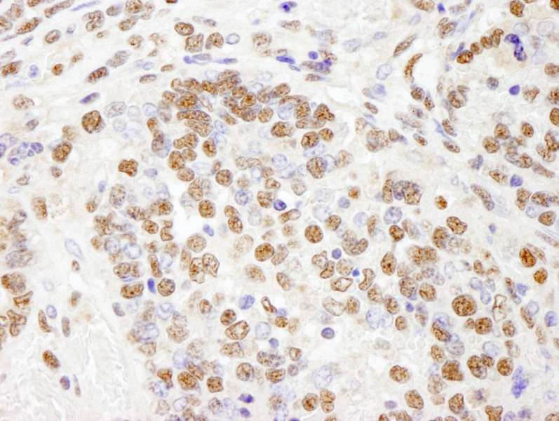 PHF8 Antibody (aa650-700)