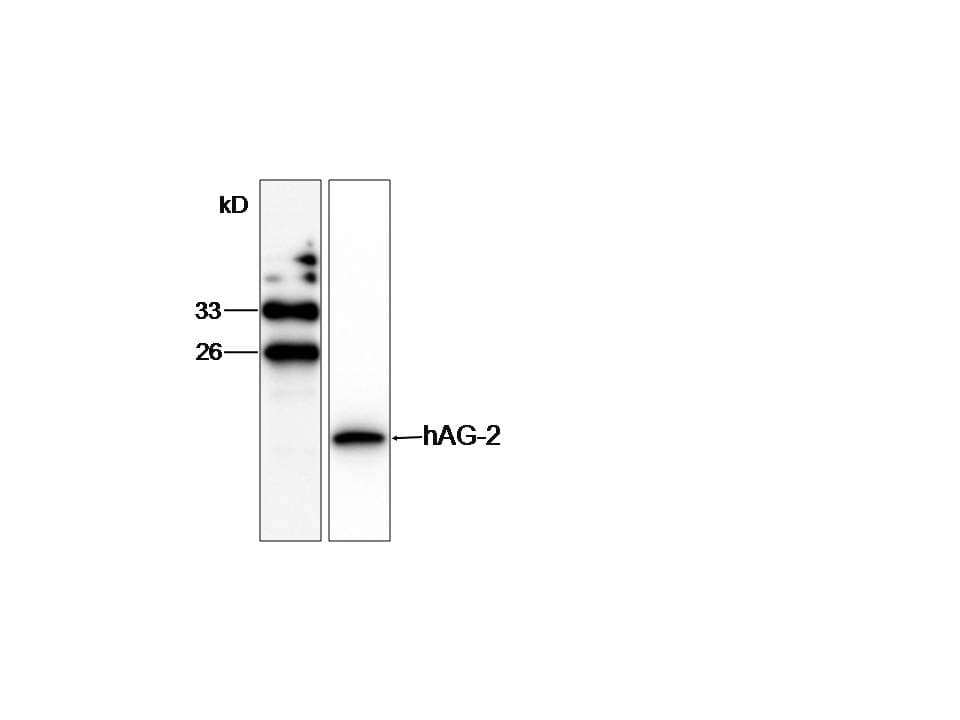 PathPlus™ AGR2 Antibody (aa21-175)
