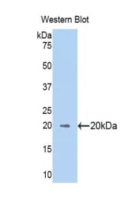 RNLS / Renalase Antibody (aa160-319)