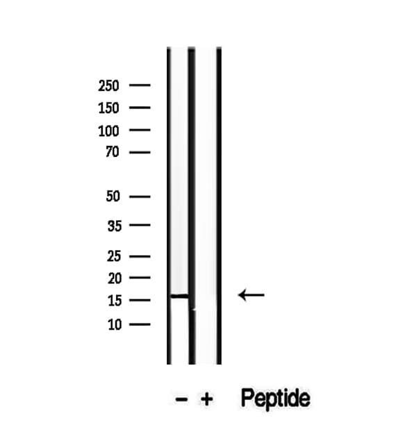 Polyclonal Rabbit anti-Human RPS14 / Ribosomal Protein S14 Antibody (IHC, IF, WB)
