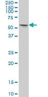 IHC-plus™ STK33 Antibody (clone 3F10)