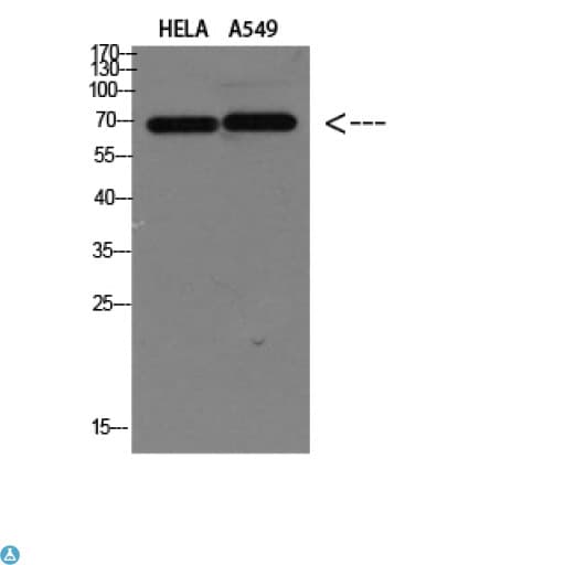 Polyclonal Rabbit anti-Human DCT / Dopachrome Tautomerase Antibody (WB)
