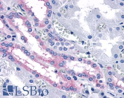 IHC-plus™ FZD4 / Frizzled 4 Antibody (N-Terminus)