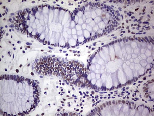 Monoclonal Mouse anti-Human ERCC1 Antibody (clone OTI2H1, IHC, WB)