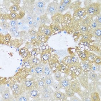 Polyclonal Rabbit anti-Human KIAA1811 / BRSK1 Antibody (IHC)